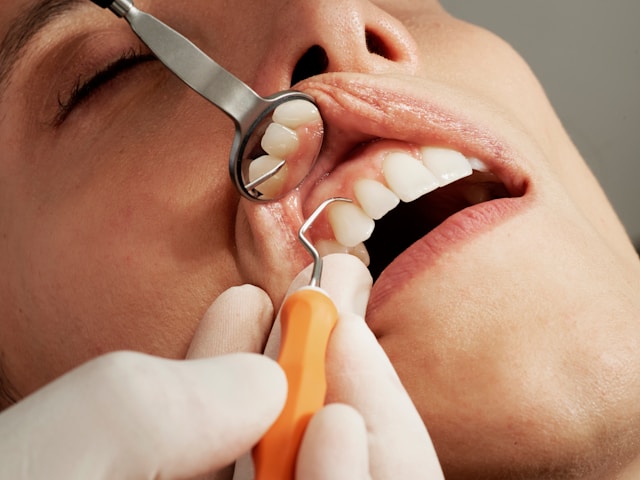 Keuntungan Melakukan Perawatan Gigi di Klinik Dokter Gigi Jakarta Secara Rutin